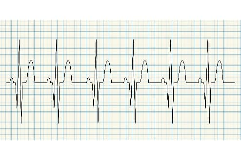 Diagnostic Procedures